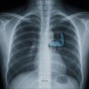 Слухати Vsivdoma – Світло